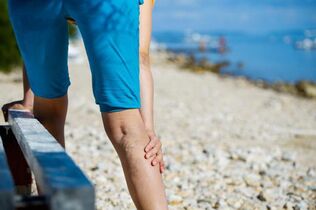 Varicose veins of the lower limbs due to physical exertion
