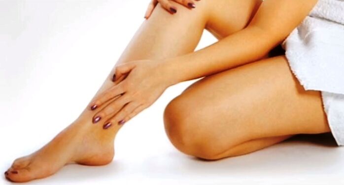 Varicose veins in the legs cause pain
